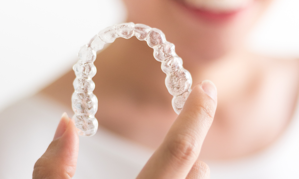 DR SMILE Erfahrungen: Kosten, Eignung und Vergleich zu Invisalign